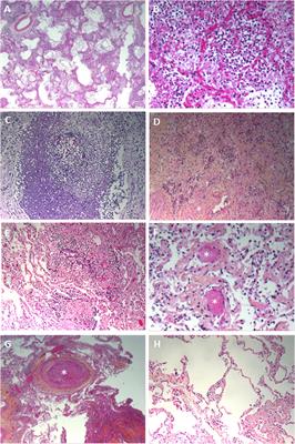 Pathology Assessments of Multiple Organs in Fatal COVID-19 in Intensive Care Unit vs. Non-intensive Care Unit Patients